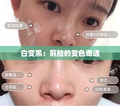 白變黑：前臉的變色奇遇