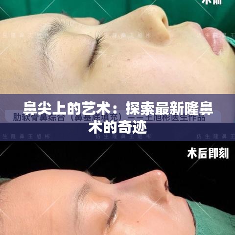 鼻尖上的藝術：探索最新隆鼻術的奇跡