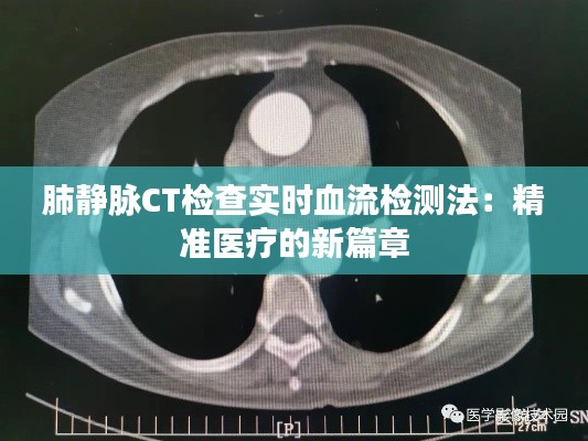肺靜脈CT檢查實(shí)時(shí)血流檢測(cè)法：精準(zhǔn)醫(yī)療的新篇章