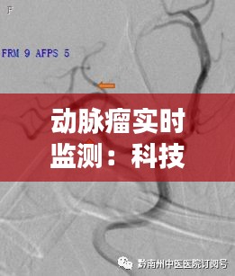 動(dòng)脈瘤實(shí)時(shí)監(jiān)測(cè)：科技守護(hù)生命線