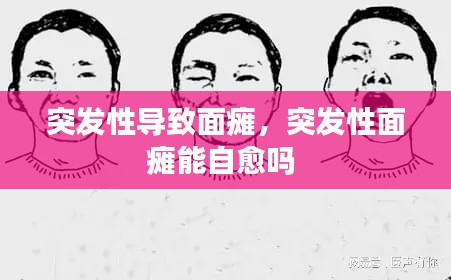 突發(fā)性導(dǎo)致面癱，突發(fā)性面癱能自愈嗎 