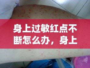 身上過敏紅點(diǎn)不斷怎么辦，身上過敏出紅點(diǎn)很癢 
