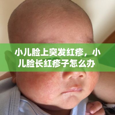 小兒臉上突發(fā)紅疹，小兒臉長(zhǎng)紅疹子怎么辦 