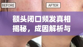 額頭閉口頻發(fā)真相揭秘，成因解析與有效應(yīng)對(duì)方案