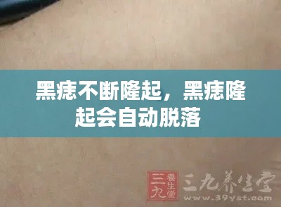 黑痣不斷隆起，黑痣隆起會自動脫落 