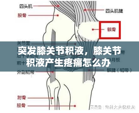 突發(fā)膝關(guān)節(jié)積液，膝關(guān)節(jié)積液產(chǎn)生疼痛怎么辦 