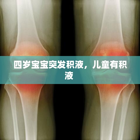 四歲寶寶突發(fā)積液，兒童有積液 