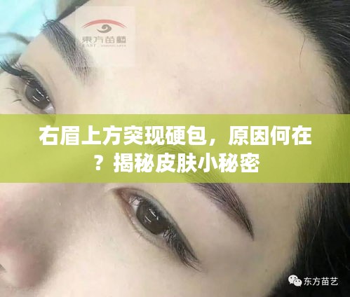 右眉上方突現(xiàn)硬包，原因何在？揭秘皮膚小秘密