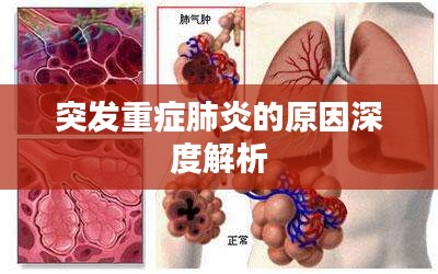 突發(fā)重癥肺炎的原因深度解析