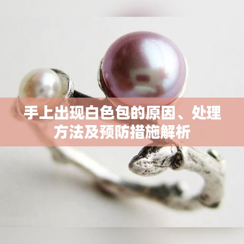 手上出現(xiàn)白色包的原因、處理方法及預(yù)防措施解析
