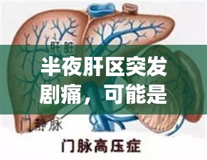 半夜肝區(qū)突發(fā)劇痛，可能是肝臟健康出現(xiàn)大問題！