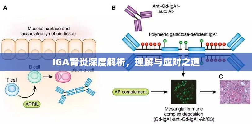 IGA腎炎深度解析，理解與應對之道
