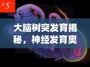大腦樹(shù)突發(fā)育揭秘，神經(jīng)發(fā)育奧秘探索之旅