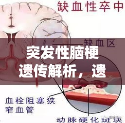 突發(fā)性腦梗遺傳解析，遺傳與腦梗有何關(guān)聯(lián)？