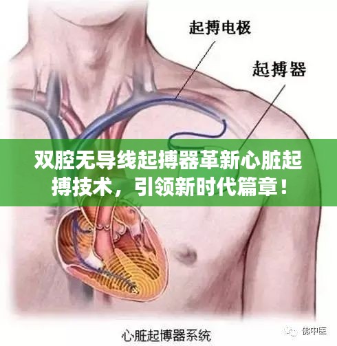 雙腔無導(dǎo)線起搏器革新心臟起搏技術(shù)，引領(lǐng)新時代篇章！