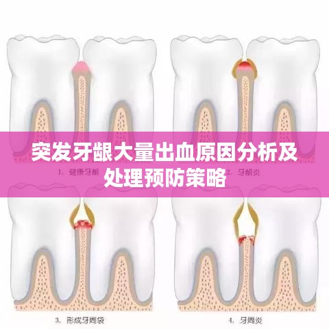 突發(fā)牙齦大量出血原因分析及處理預防策略