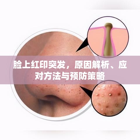 臉上紅印突發(fā)，原因解析、應(yīng)對(duì)方法與預(yù)防策略